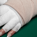 Kurs terapii przeciwobrzękowej KTP