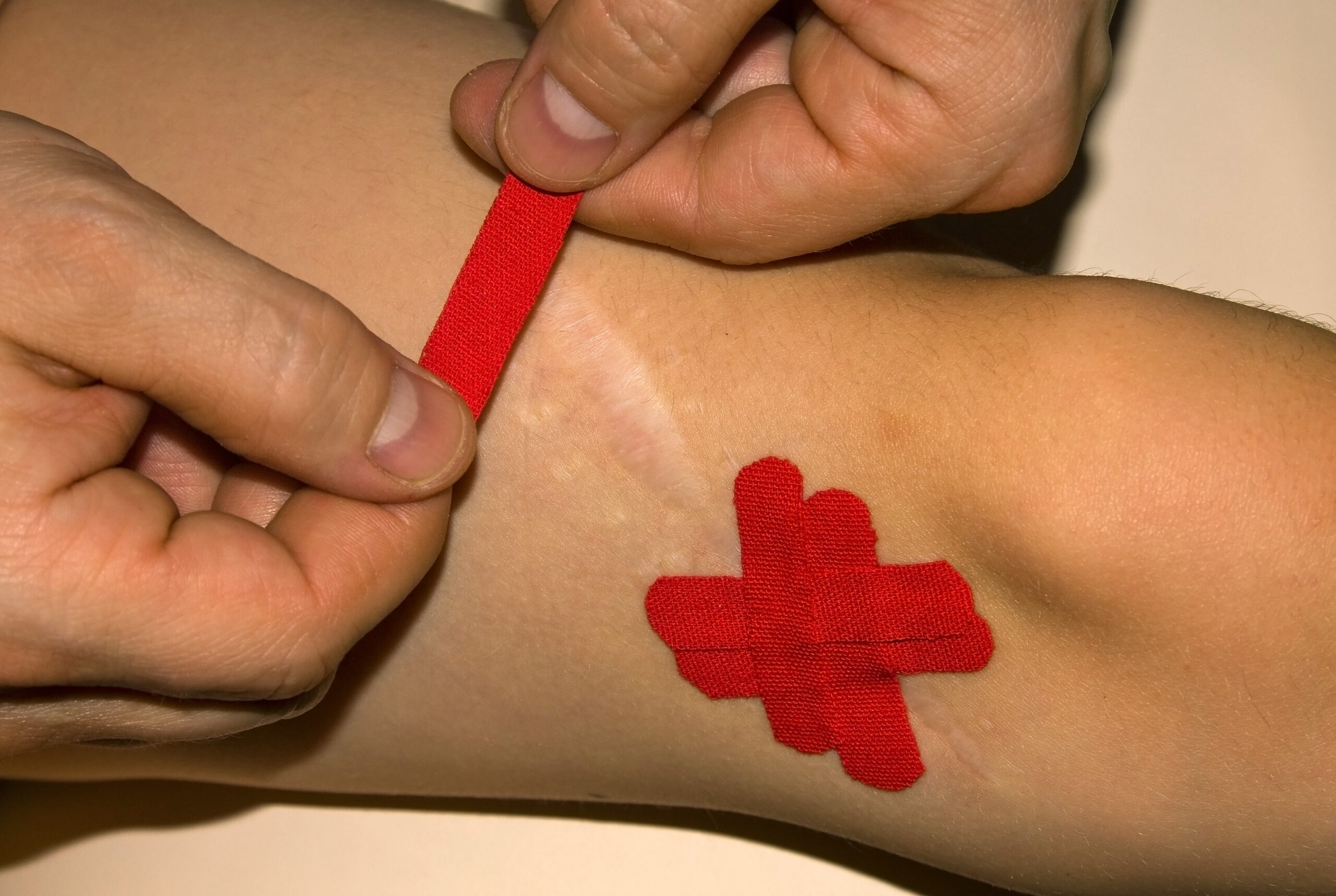 Blizna - problem nie tylko estetyczny