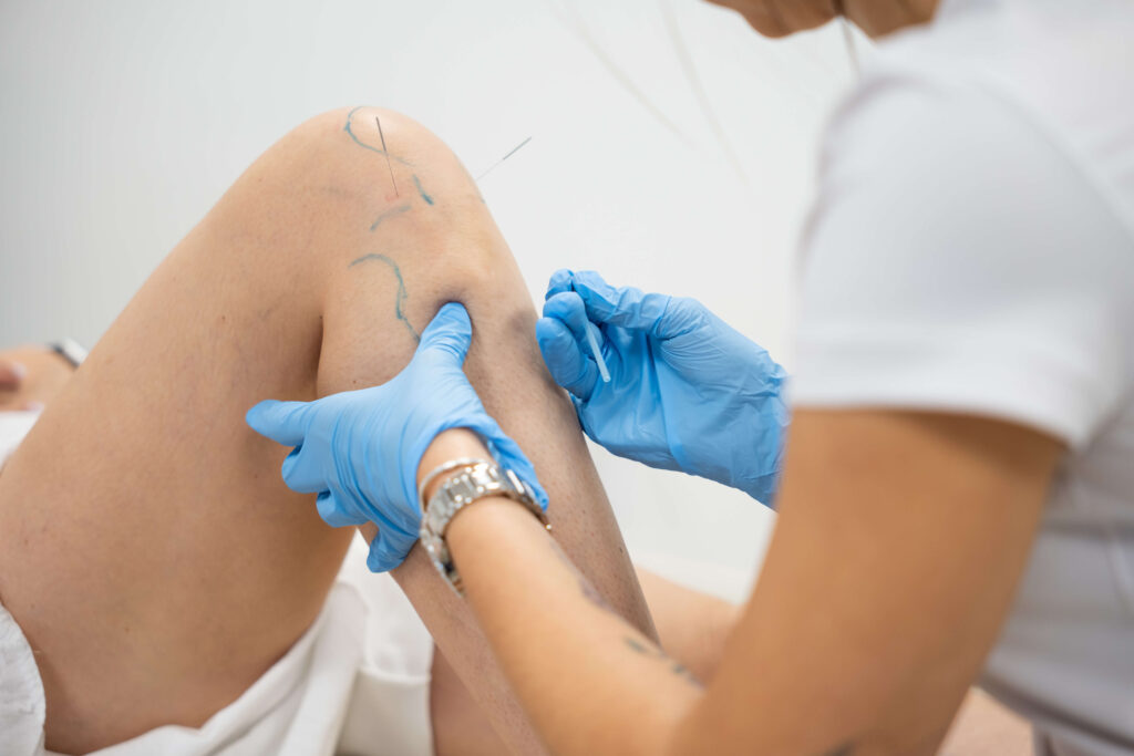 suche igłowanie kurs