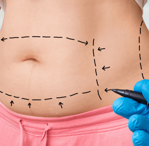 Kurs fizjoterapia po chirurgii plastycznej