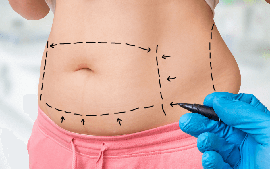 Kurs fizjoterapia po chirurgii plastycznej